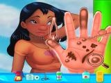 Jugar Nani pelekai hand doctor game online now