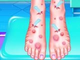 Jugar Emma foot treatment