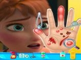 Jugar Anna frozen hand doctor: fun games for girls onlin